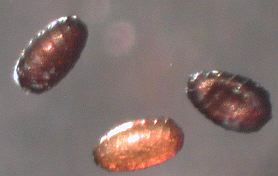 ケナガシャジクモ卵胞子